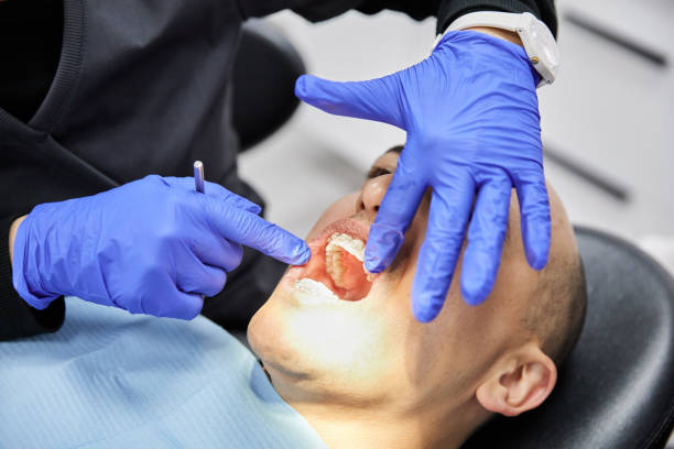 Best Emergency Dental Care for Sports Injuries in Beardstown, IL