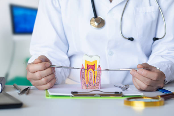 Best Knocked-Out Tooth (Avulsed Tooth) Treatment in Beardstown, IL